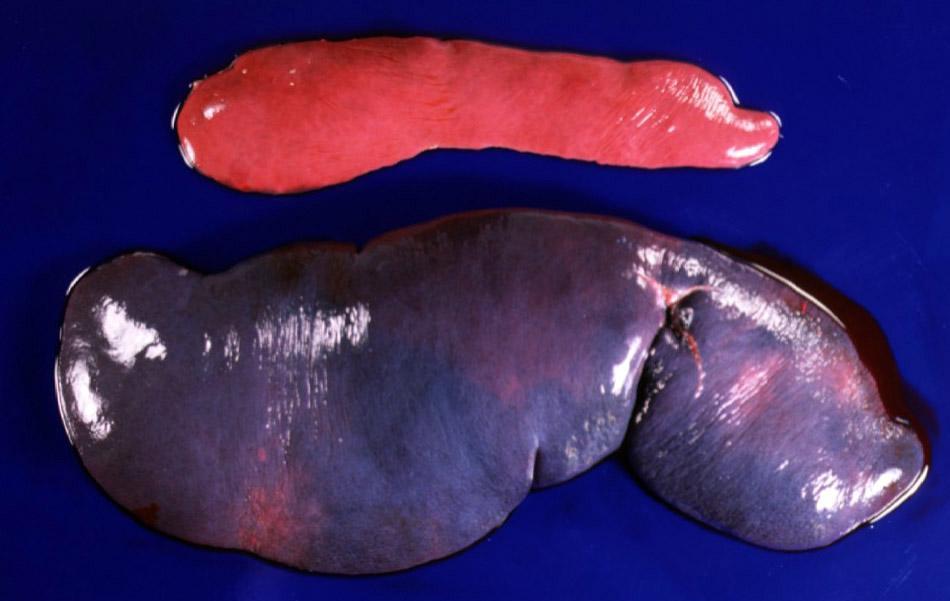 Diffuse Splenomegaly: Bloody vs Meaty Normal dog spleen Spleen from a dog with gastric torsion Photo: