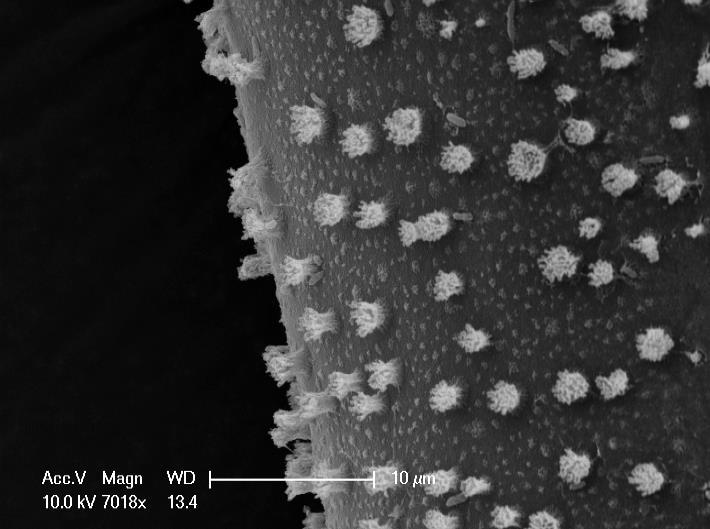 15 (432-477) µm, width = 63 µm. Surface covered in ansulae (Fig.