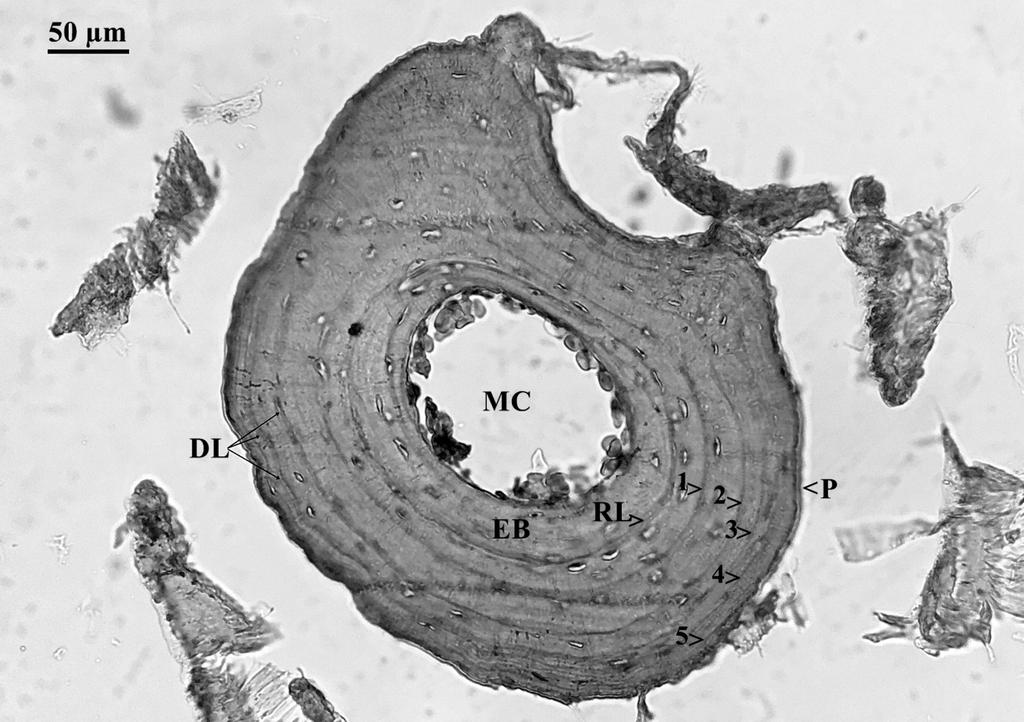 128 a. İ. eroğlu & U. BüLBüL & m. KURNaz fig. 1: Cross section (15µm thick) of a toe bone of a five-year-old female (58.