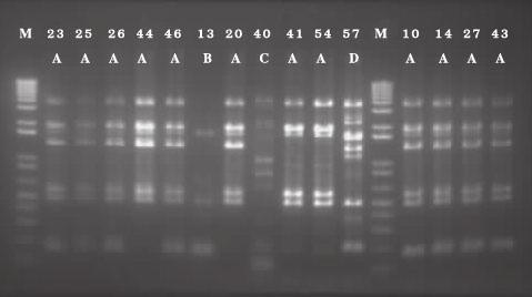 Primers and PCR conditions are described in Materials and Methods.