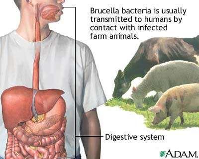 Humans acquire brucellosis from exposure to infected animals (direct contact with infected animal parts) or contaminated animal products (unpasteurized