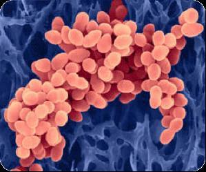 What Is MRSA? MRSA = Methicillin resistant Staphylococcus aureus Wound that will not heal caused by drug resistant Staph.