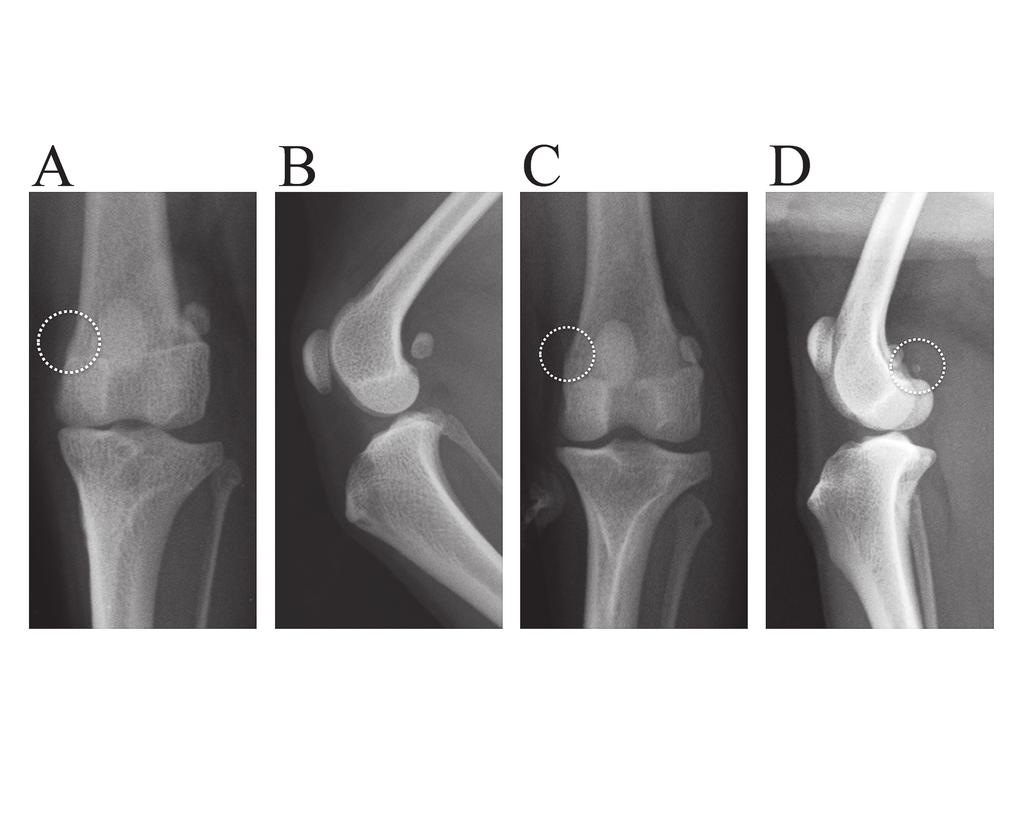 44 Fabella displacement or deformity in dogs Fig. 3. Deformity of the medial fabella. (A) Aplasia (craniocaudal view of the left stifle). (B) Aplasia (mediolateral view of the left stifle).