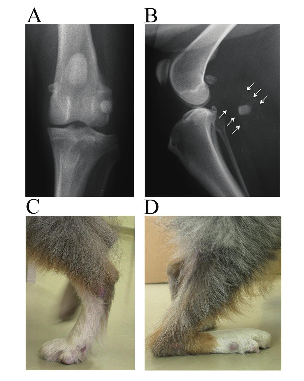 46 Fabella displacement or deformity in dogs Fig. 4. (A) Craniocaudal radiograph and (B) mediolateral radiograph of traumatic avulsion of the lateral head of the gastrocnemius muscle.