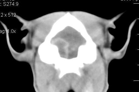 8), the diagnosis results from the visualization of a lesion typically characterized by a necrotic core and a peripheral ring normally enhancing after contrast medium administration on both CT and