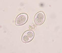 Parasite identification 1) Fecal flotation or egg count