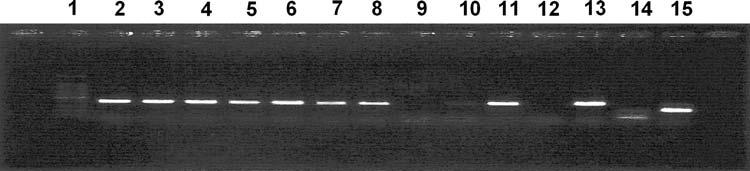 302 Environ Health Prev Med (2009) 14:299 303 Fig. 3 DNA amplification from ten taeniid-positive fox faeces using multiplex PCR. Lanes: 1 100-bp ladder, 2 11 samples, 12 negative control, 13 E.