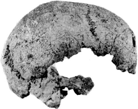 Jan Jelínek A B C FIGURE 9. Trephined skull No. 22 from Polepy by Kolín in Bohemia (Únětice Culture, Early Bronze Age).