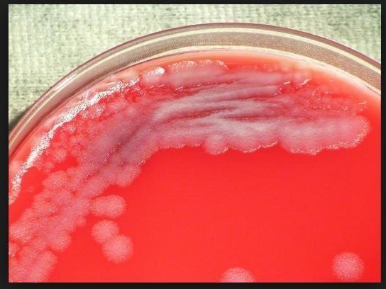 Bacillus diagnosis: blood agar: (medusa head) grey wavy with