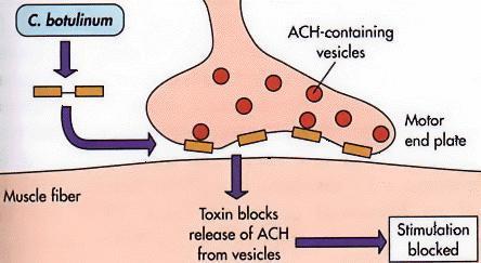 Clostridium botulinum Pathogenesis: Neurotoxin production > stomach absorption > circulation >