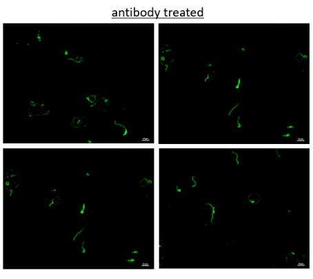 in untreated versus antibody treated sporozoites.