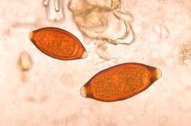 Adults build up immunity Whipworms Trichuris
