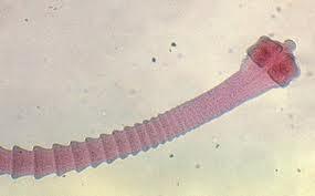Tapeworm Dipylidium caninum Vector = Ctenocephaldies canis More on