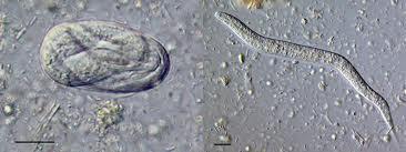 or free living organism Often missed on fecal flotation (dense) Larva