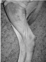 of the humerus Tibial tuberosity Greater