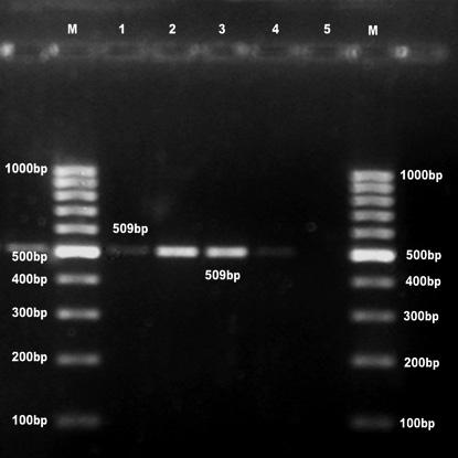 Standardization of PCR for detection of stra gene. FIG. 5. Standardization of PCR for detection of strb gene.