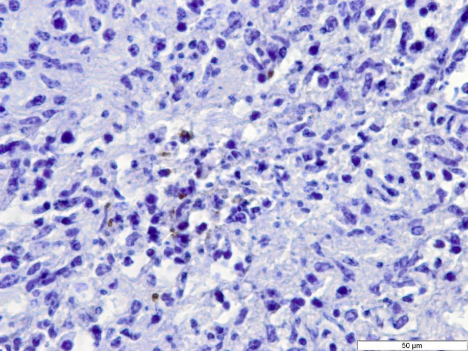 The most characteristic lesion in neosporosis is focal encephalitis characterized by necrosis and non suppurative inflammation (Wouda et al., 1997).