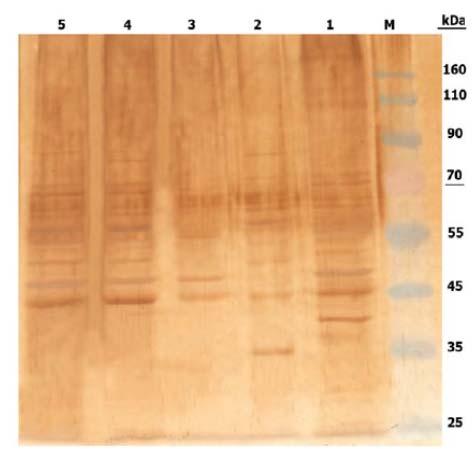Fig.1: Western blot analysis of different antigens of H.contortus against positive sera.