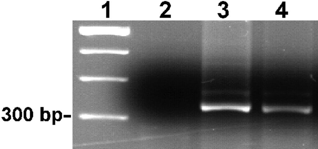 GONDIM ET AL. NEOSPORA CANINUM IN WILD AND DOMESTIC ANIMALS 6 FIGURE. PCR for Neospora caninum using Np2 Np6 primers (Yamage et al., 996).