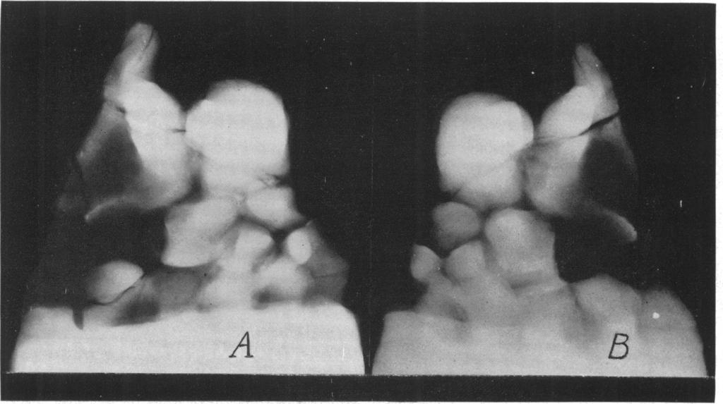 1941] PES OF BAURIA CYNOPS 5 tragalar facet is convex, while the distal articular surface is quite flat. The latter articulates with the ecto-, meso-, and proximolateral corner of the entocuneiform.