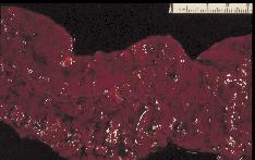 Photo1: Thin carcass bovine Salmonellosis Photo 2: Lung abscess bovine Salmonellosis Photo 3: Infarcts in the kidney with bovine