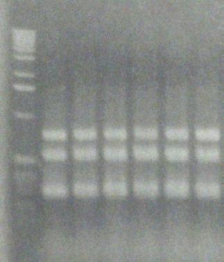 III. Identification MRSA Multiplex PCR: 3 genes meca methicillin resistance, PBP2a nuc Staphylococcus aureus specific,