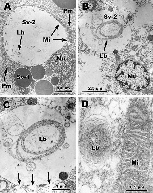 272 CHELONIAN CONSERVATION AND BIOLOGY, Volume 12, Number 2 2013 Figure 5. Transmission electron micrographs of Rathke s glands in hatchling Terrapene carolina triunguis. A. Holocrine cell of axillary gland showing type 1 and type 2 secretory vacuoles.