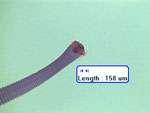Hymenolepis nana - The Dwarf Tapeworm Morphology - small, 2 to 4 cm