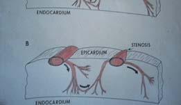 bronchus branches from the trachea directly and