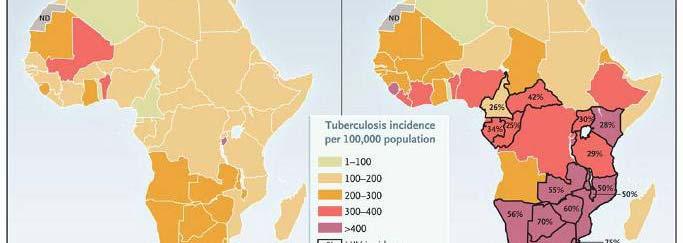 Incidence of Tuberculosis per 100,000 Population in African Countries in 1990 and Estimated Incidence of 2005 TB/100,000 Population in African Countries in 1990 & 2005 Chaisson R and