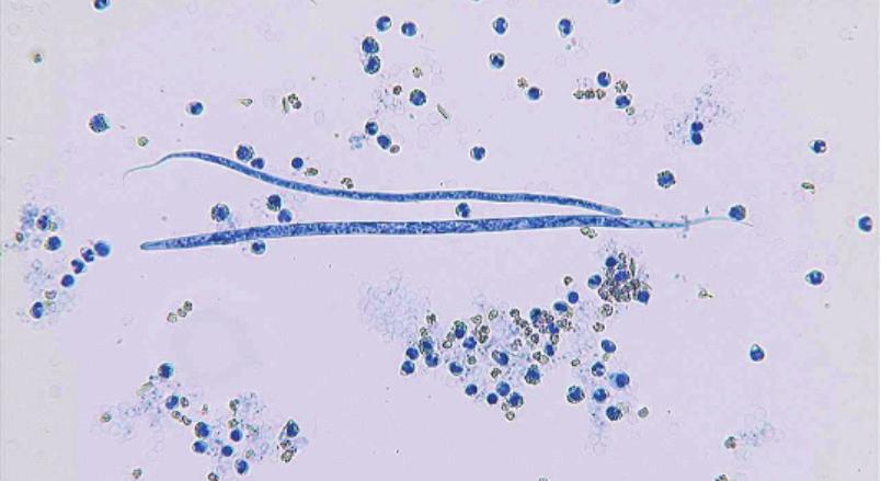 Figure 3. Acnthocheilonem reconditum (top) nd Dirofilri immitis (below). Photogrph courtesy of Byron Blgburn, PhD.