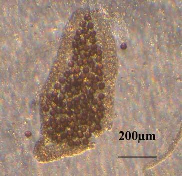 A B Adult worms of Echinococcus (a)
