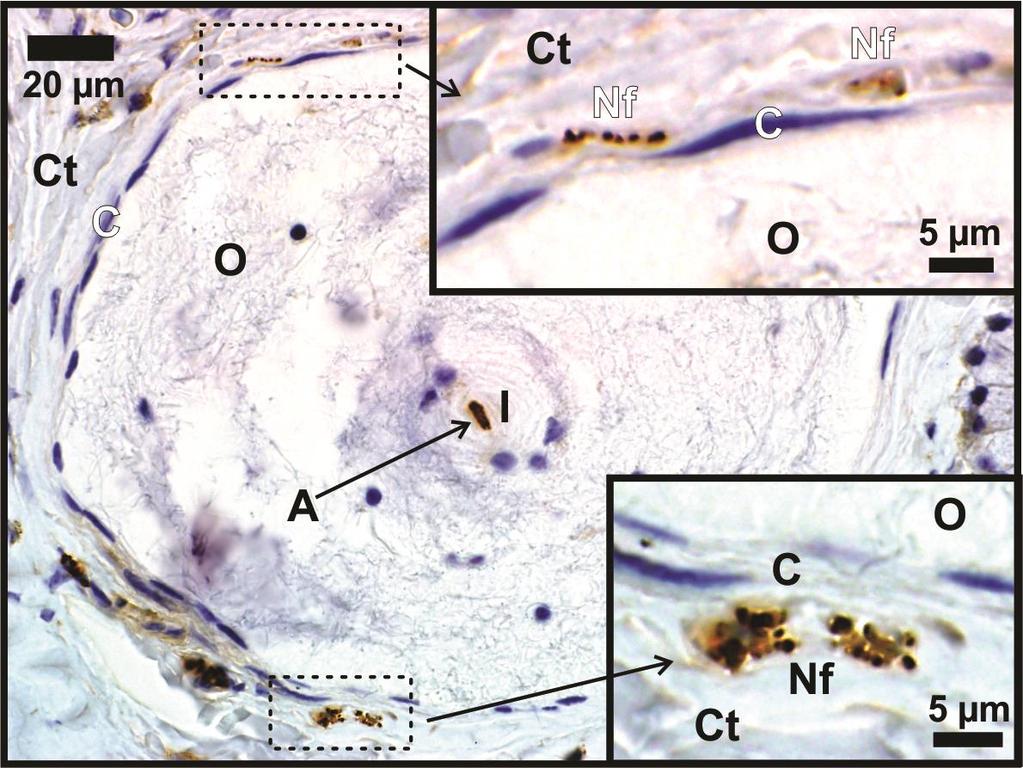 Fig. 2. Positive IHC labelling for neuro-filament (Nf) in a Herbst corpuscle in the emu.