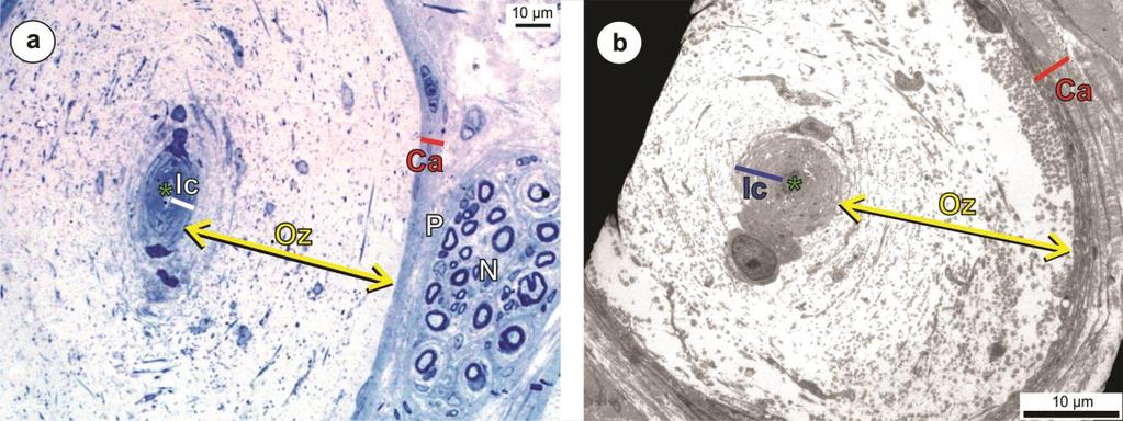 Fig. 3. Low magnification transverse sections of Herbst corpuscles from the oropharynx of the ostrich (a) (LM - toluidine blue stain) and emu (b) (TEM).