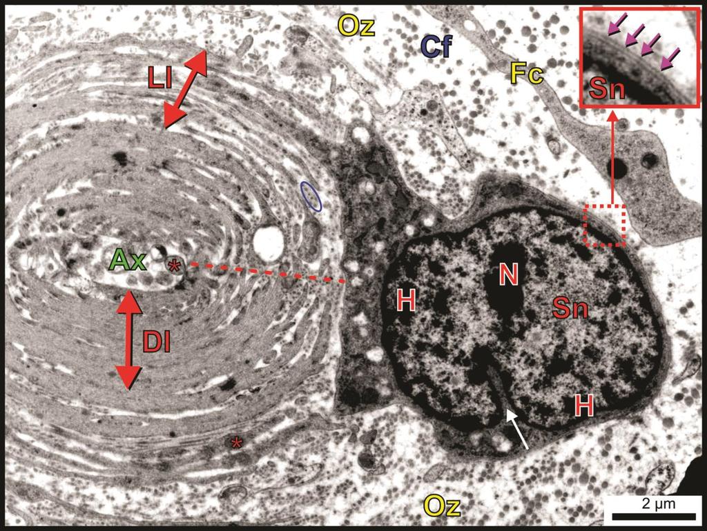 Fig. 7. Inner core of a Herbst corpuscle in the ostrich. Note the large, indented (white arrow) Schwann cell nucleus (Sn) with a prominent nucleolus (N) and clumps of heterochromatin (H).