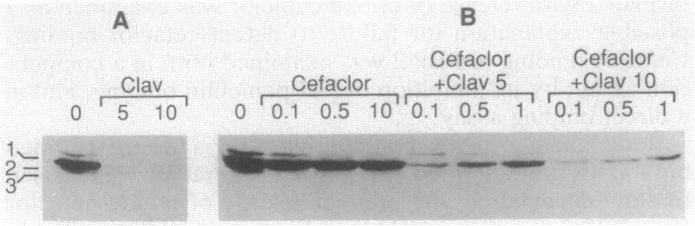 658 CHAMBERS AND MIICK ANTiMICROB. AGENTS CHEMOTHER. No drug Clav 5 75-4 C a o aż 50. 8% 1 a.0 r Goa Cecbor 0.05.0 ~~~~~~~~~~~~~~Cofaclor 0.125 Clay + Ceclor 0.05 0.0.... I I " 0 1 2 