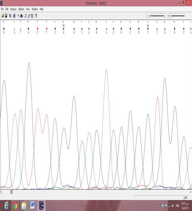Figure 5: DNA sequencing graph showing the nucleotide sequence of aac (6 )-ib-cr gene compared to reference strain.