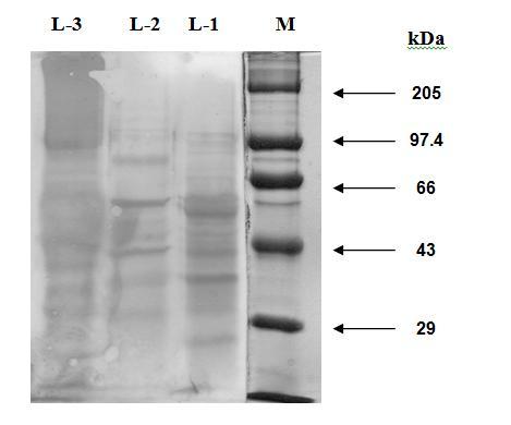 Discussion Fig.3: Western Blotting Pattern of CSAg-Hc (L-1), CSAg-Oc (L-2) and CSAg-To (L-3) Five immuno-reactive polypeptides (90, 51, 47, 39.