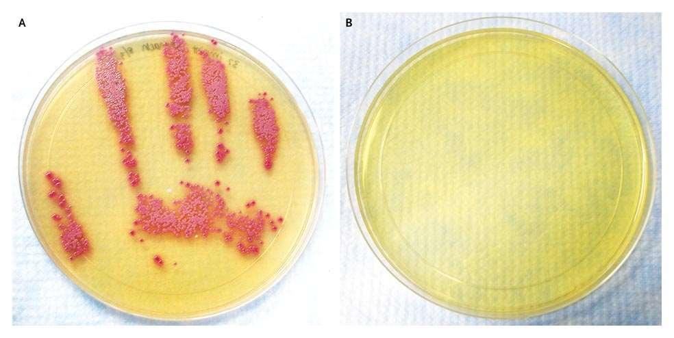 Abdomen of an MRSA positive patient examined by a physician Hand cultured for MRSA before and after using