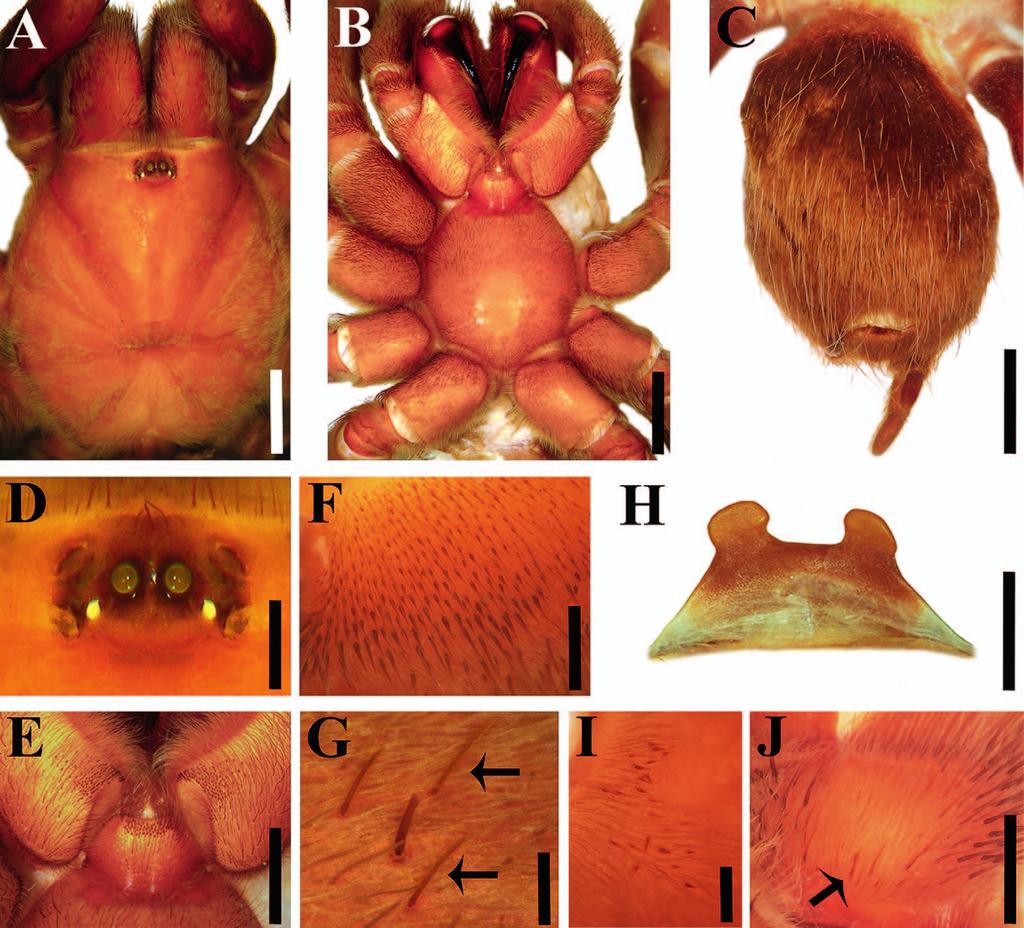 80 JOURNAL OF ARACHNOLOGY Figure 10. Crassicrus bidxigui sp. nov. female paratype: A. Carapace. B. Prosoma, ventral view. C. Abdomen, dorsal view. D. Ocular tubercle. E.