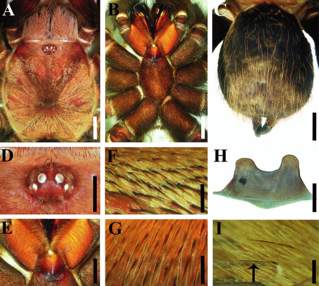 CANDIA-RAMÍREZ & FRANCKE TAXONOMIC REVISION OF CRASSICRUS 91 Figure 16. Crassicrus cocona sp. nov. female paratype: A. Carapace. B. Prosoma, ventral view. C. Abdomen, dorsal view. D. Ocular tubercle.