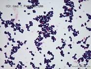 Staphylococcus aureus Common Many sites especially blood, wounds