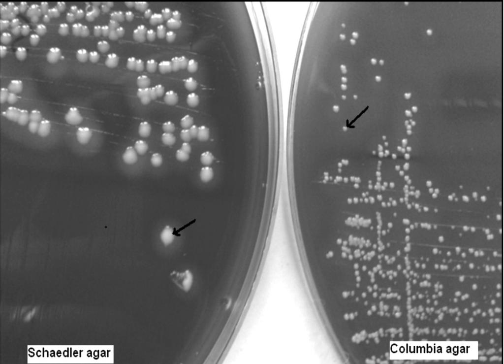 Southeast Asian J Trop Med Public Health Fig 1 Hemolysis feature and colony sizes of S. aureus SCVs on Schaedler and Columbia agar plates. Fried egg colonies on Schaedler agar (left).