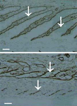 epidermal lamellar basement membrane (BM) has been immunolabelled using monoclonal antibodies specific for the basement membrane protein laminin (arrows).