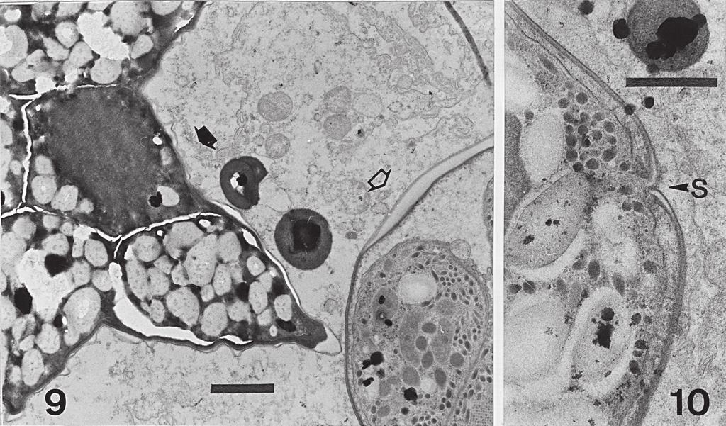 HEMOLIVIA MAURITANICA IN TORTOISE AND TICKS Figs 9-10. Electron micrographs of Hemolivia mauritanica sporocysts, scale bar = 1 µm. Fig. 9. Early (open arrow) and ripened (dark arrow) sporocysts. Fig. 10.