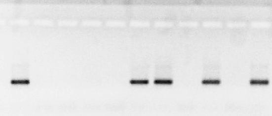 144 C. Bulla et al. Figure 1. Representative electrophoretic agarose gel results for the nested PCR assay testing for the presence of E.