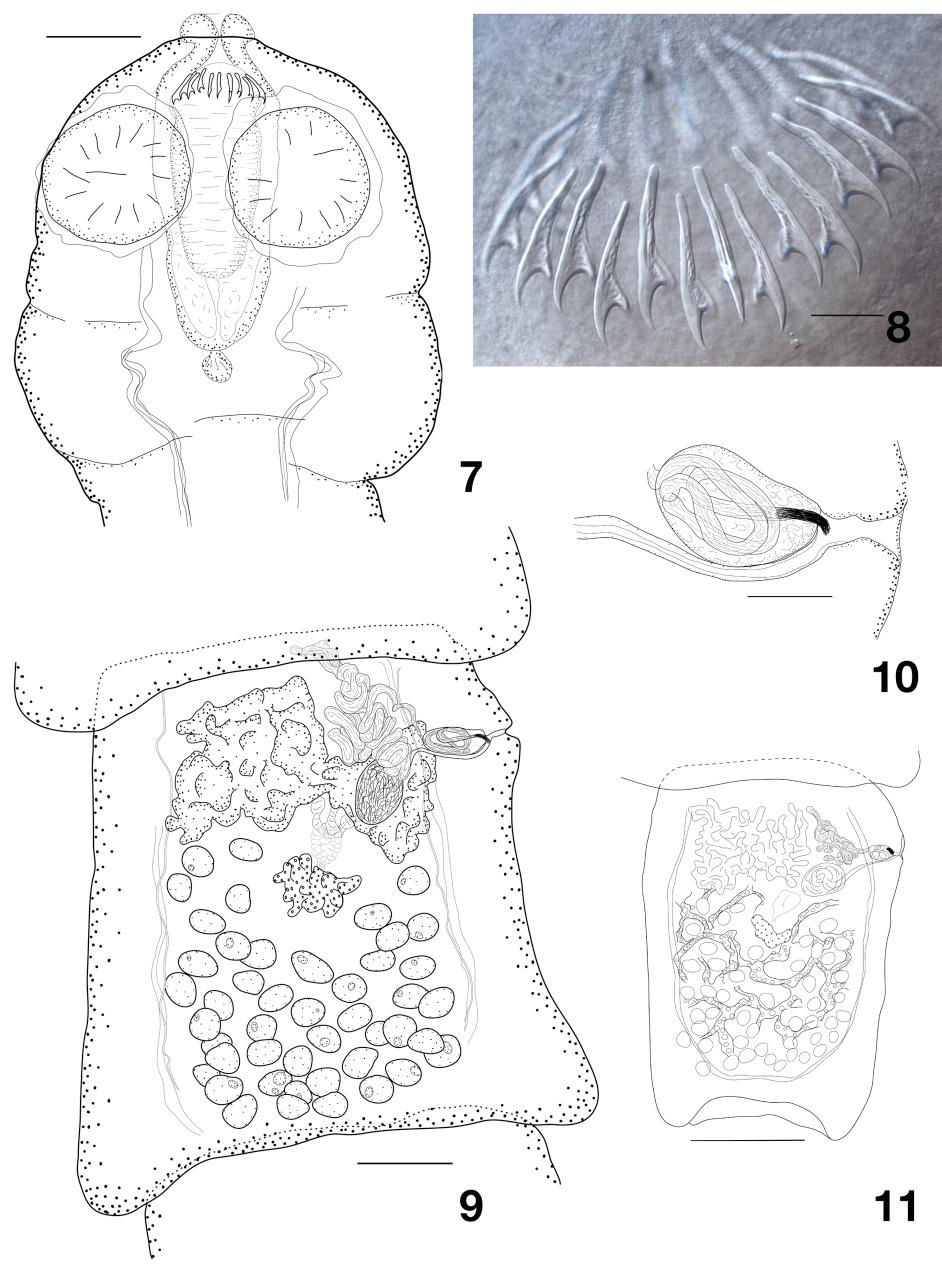 European Journal of Taxonomy 440: 1 42 (2018) Figs 7 11. Spiniglans beveridgei sp. nov. 7. Scolex. 8. Hooks. 9. Mature proglottis. 10.