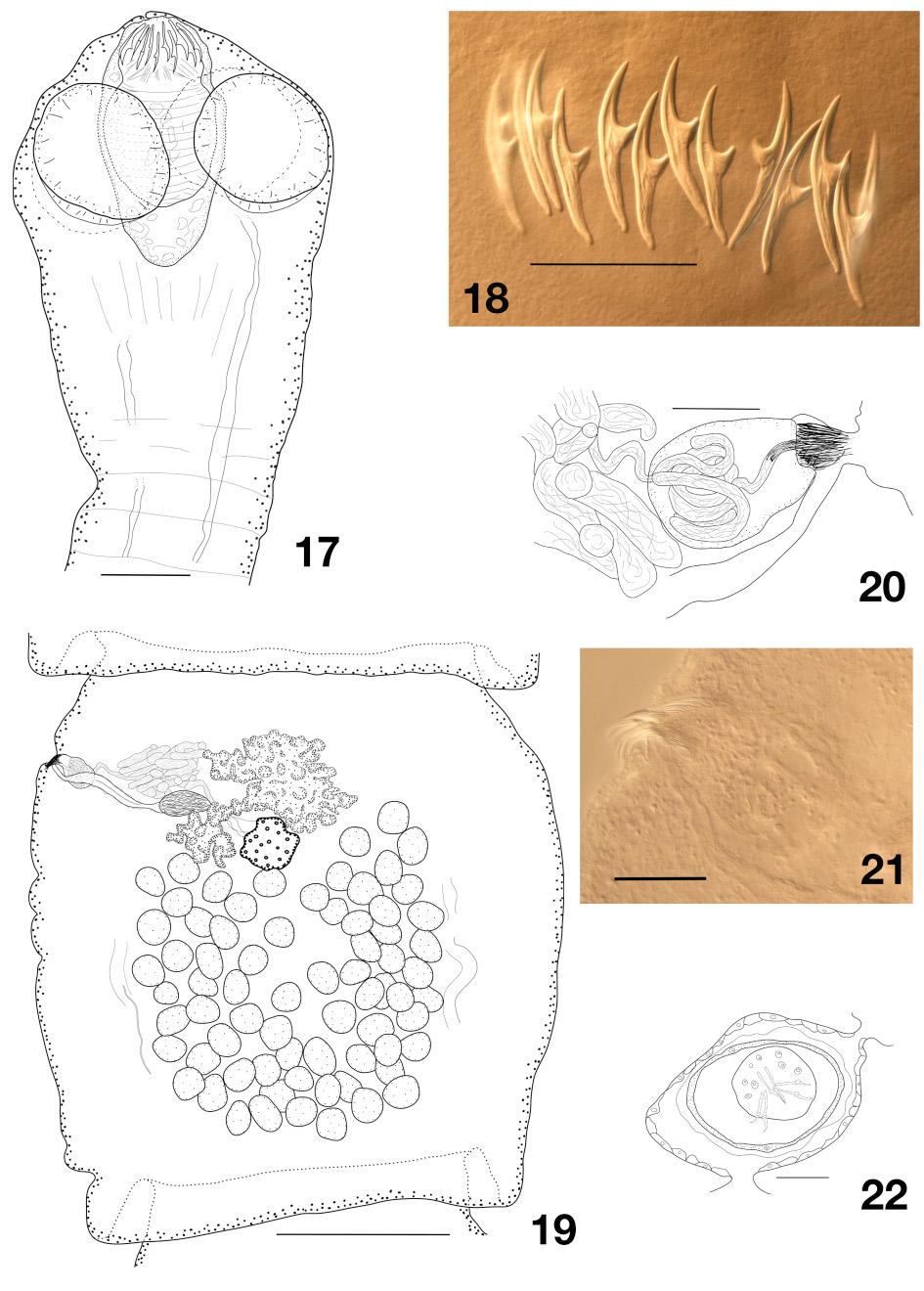 MARIAUX J. & GEORGIEV B.B., Cestodes from Australian birds Figs 17 22. Dictymetra gerganae sp. nov. 17. Scolex. 18. Hooks. 19.