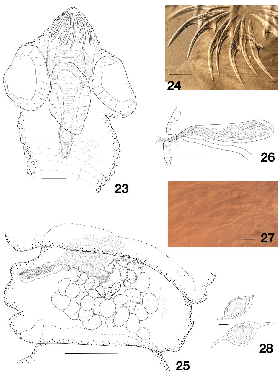 European Journal of Taxonomy 440: 1 42 (2018) Figs 23 28. Dictymetra longiuncinata sp. nov. 23. Scolex. 24. Hooks. 25. Mature proglottis.