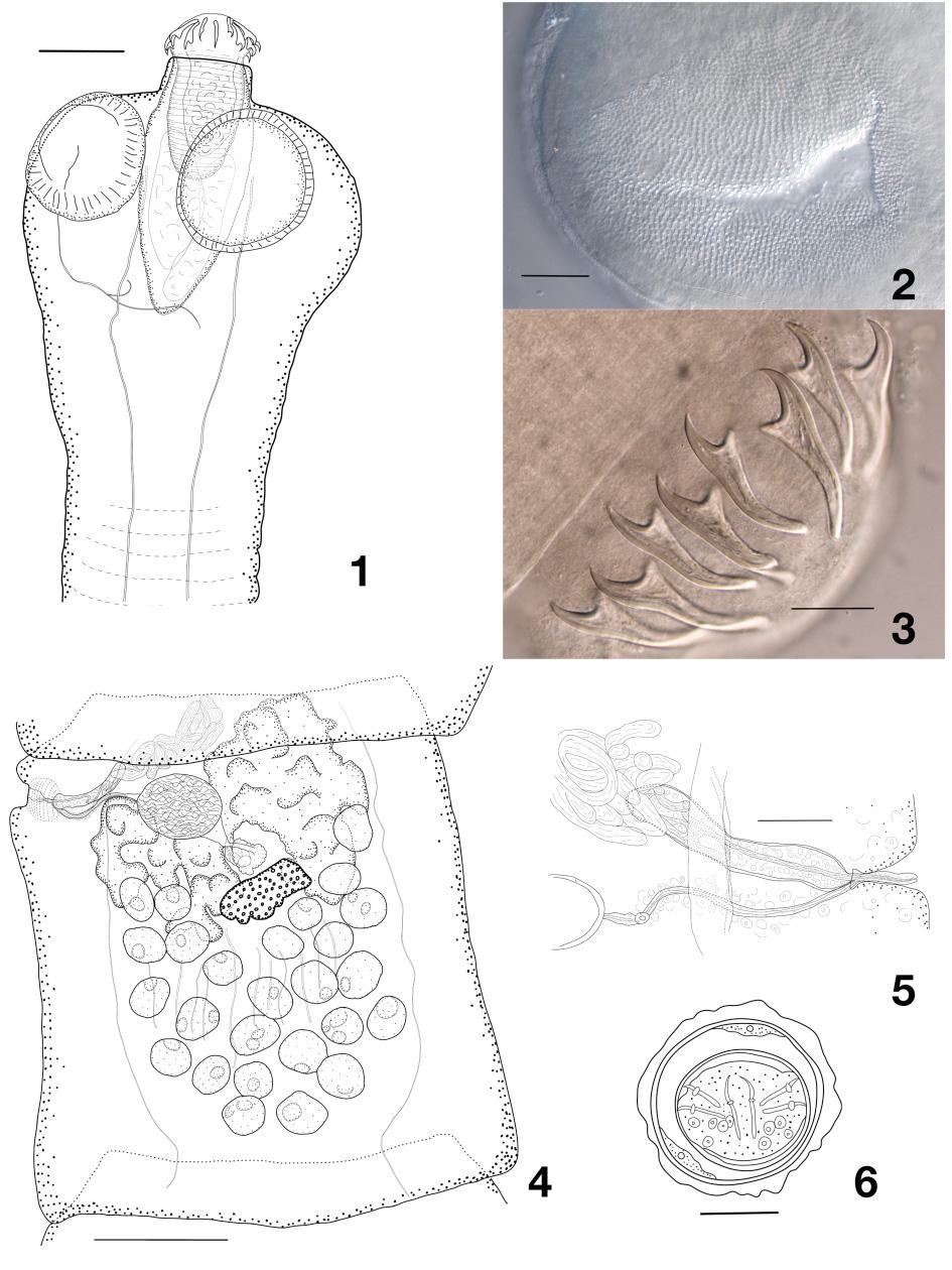 European Journal of Taxonomy 440: 1 42 (2018) Figs 1 6. Sobolevitaenia whittingtoni sp. nov. 1. Scolex. 2. Sucker armament. 3.